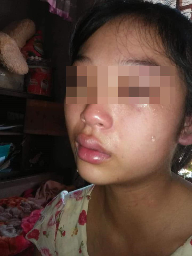 Vợ 16 tuổi “tố” bị chồng siết cổ, đánh đuổi hai mẹ con ra khỏi nhà khiến CĐM dậy sóng