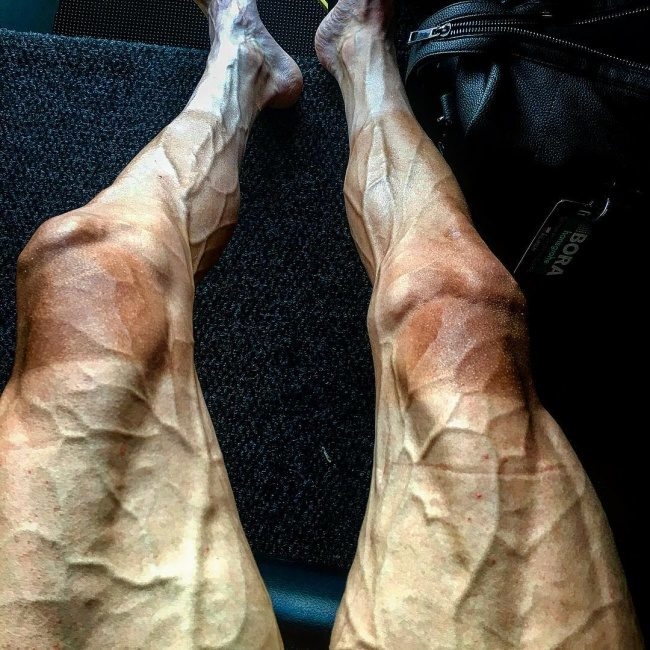 
Đôi chân gân guốc của VĐV xe đạp Paweł Poljański sau 16 giải đua xe đạp nổi tiếng thế giới Tour de France