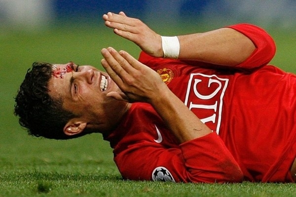 
Trong trận đấu tại Champions League với Roma, sau 1 pha húc khuỷu tay của Vucinic, máu đã đổ trên khuôn mặt điển trai của CR7