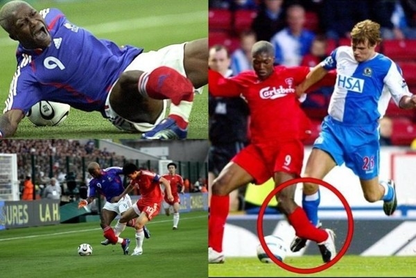 
Trên sân cỏ thế giới, hiếm có cầu thủ nào đen đủi như cầu thủ người Pháp, Djibril Cisse khi trong sự nghiệp đã gặp tới 2 chấn thương gãy chân kinh hoàng...
