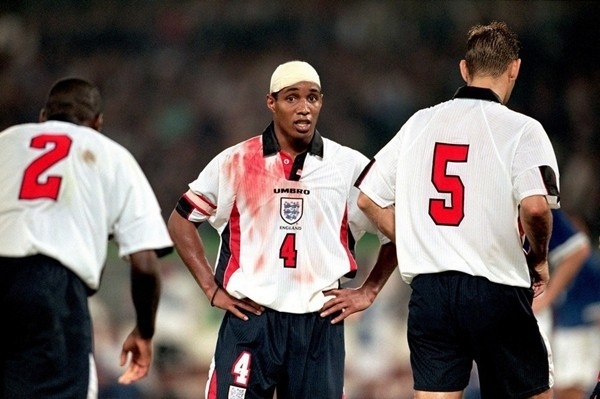 
Các cựu tuyển thủ Anh có lẽ là những người đổ máu nhiều nhất, Paul Ince cũng khiến chiếc áo trắng của anh trở thành hai màu với việc bị vỡ đầu.