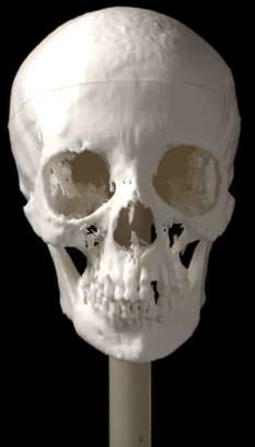 
Các chuyên gia bắt đầu tạo dựng mẫu khung sọ bằng công nghệ in 3D.