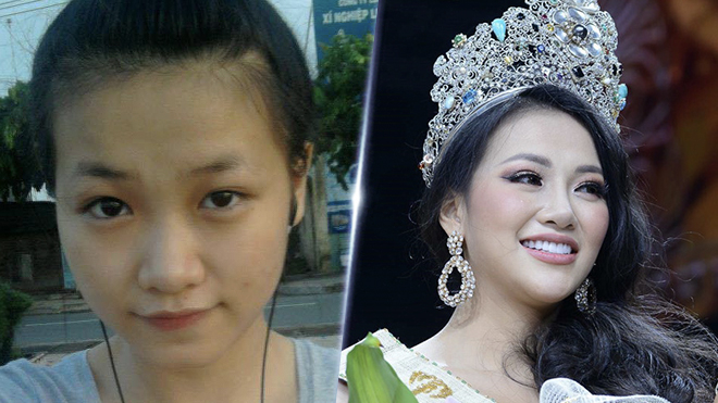 
Sau khi đăng quang Hoa hậu Trái đất, nhan sắc của Phương Khánh trở thành đề tài bàn tán của cư dân mạng. Nhiều người cho rằng, người đẹp đã đụng chạm đến thẩm mỹ để có được vẻ đẹp như hiện tại. 