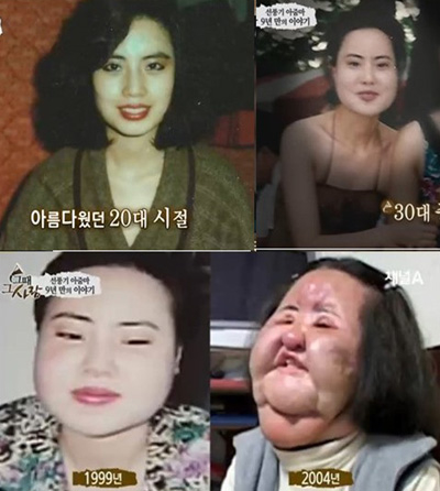 
Gương mặt của Han Mi Ok ngày càng biến dạng
