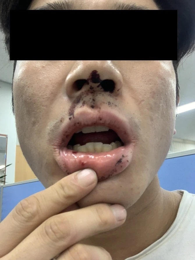 
Kim đăng tải hình ảnh anh bị thương sau vụ bạo hành