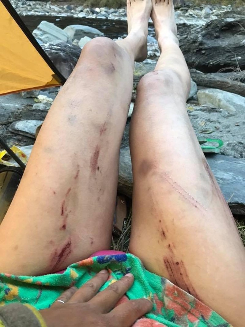 
Tấm ảnh Gigi Wu đăng tải vào Giáng Sinh, cho thấy cô suýt chết vì bị té khi leo núi.