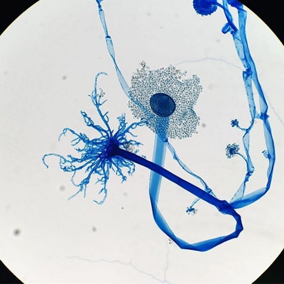 
Đây là hình dạng của loài nấm Syncephalastrum, trông nó giống như một bông hoa màu xanh kỳ lạ.