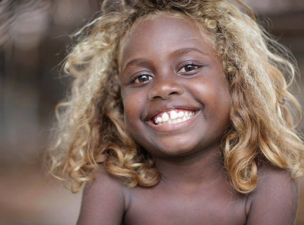 
Những người bản địa thuộc chủng tộc Melanesia sống trên các đảo nhỏ thuộc quần đảo Solomon nằm giữa Thái Bình Dương, họ có làn da đen và mái tóc vàng bẩm sinh.