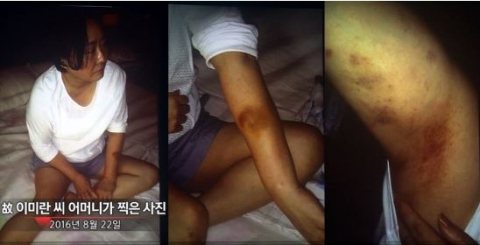 
Trước đó, mẹ của bà Lee Mi Ran đã chụp được những vết bầm tím trên cơ thể con gái.