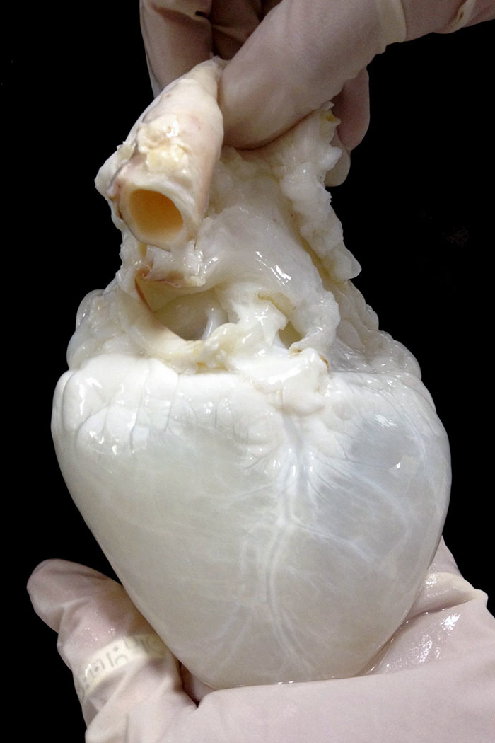 
Đây là hình ảnh của một trái tim đã được lấy sạch các mạch máu và hệ thống protein. Sau khi lấy trái tim của người hiến tặng, người ta sẽ thực hiện điều này trước khi tiêm tế bào gốc của người được nhận tim. Khi đó, cơ thể được ghép tim mới tiếp nhận trái tim này thành công.