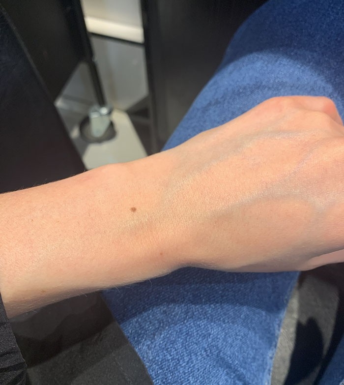 Phát hiện đầy thú vị: Hóa ra phụ nữ nào cũng có nốt ruồi trên cổ tay