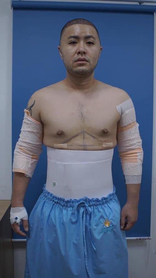  
Hình ảnh Akira Phan trong cuộc đại phẫu thuật.