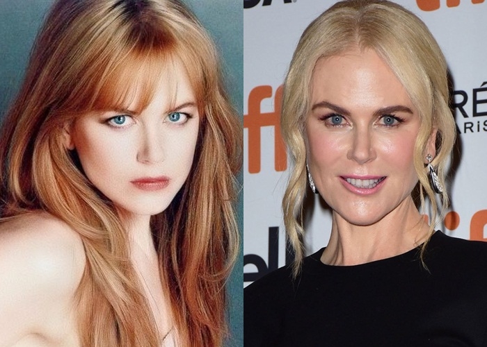  
"Thiên nga nước Úc" Nicole Kidman khiến nhiều người tiếc nuối nhan sắc năm xưa.