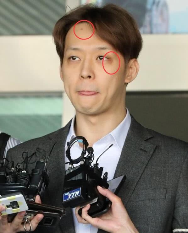  
Yoochun liên tiếp phủ nhận nhưng netizen lại soi ra được nhiều dấu vết đáng ngờ trên gương mặt anh.