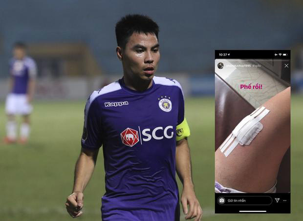  
Đức Huy cũng gặp chấn thương và bỏ ngỏ khả năng có mặt ở trận đấu gặp ĐT Thái Lan