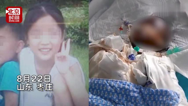 Bé gái 14 tuổi thiệt mạng vì làm bắp nổ bằng lon nước ngọt