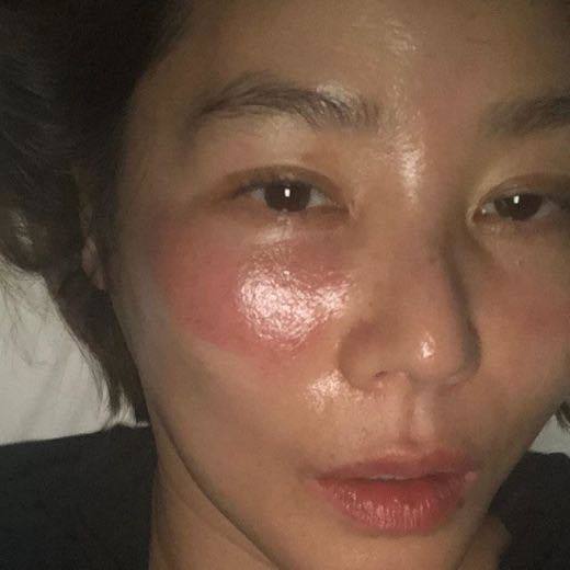  Vùng da dưới mắt của Kim Sung Ryung bị sưng tấy vì để mặt nạ qua đêm.​