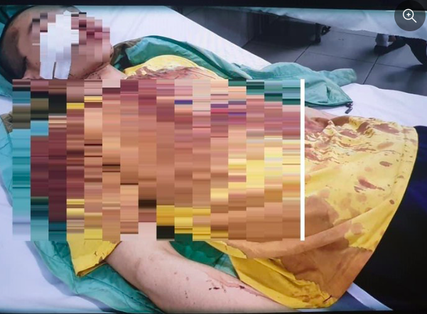  
Ít nhất 1 tu sĩ bị thương ở mặt vô cùng nghiêm trọng do bị người phụ nữ ném gạch men vào (Ảnh: tintaynguyen)