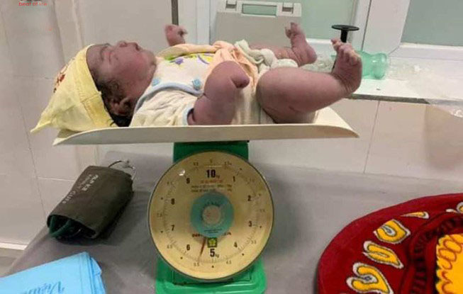  
Em bé nặng 5,5 kg ra đời hoàn toàn khỏe mạnh (Ảnh: FB)