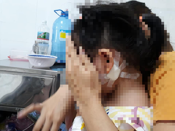  
Bệnh nhân nhi P.B.T.N (5 tuổi, Tây Sơn, Bình Định) bị nhiễm khuẩn Whitmore (Ảnh: Thái Thịnh)