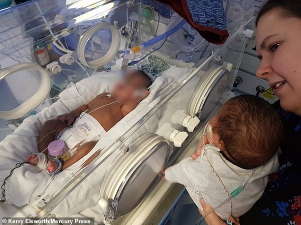  
Hai bé chào đời với cân nặng chưa tới 1kg. Các bác sĩ đặt bé vào trong một chiếc túi nilon y tế để giữ ấm.