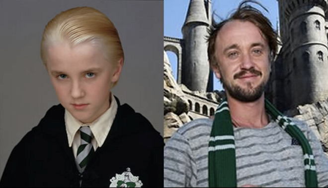  
Nhan sắc bị giảm sút trầm trọng của nam diễn viên từng thủ vai Draco Malfoy.
