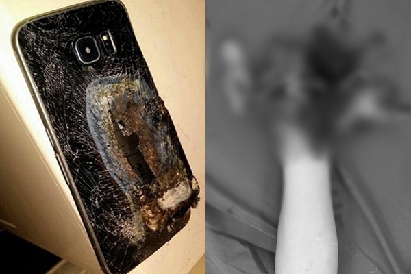  
Chiếc điện thoại và bàn tay bị dập nát của thiếu niên (Ảnh: Vietnamnet)