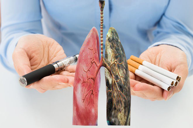  
Thuốc lá là tác nhân dẫn đến căn bệnh ung thư phổi. (Ảnh minh họa: GHV)