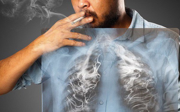  
Thuốc lá sẽ gây hại đến phổi của bạn cũng như những người hít phải khói thuốc. (Ảnh minh họa: cafebiz)