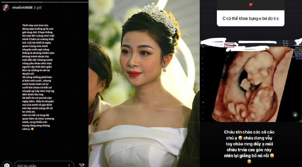 
Cô nàng chia sẻ về việc "cưới chạy bầu" trước đây (ảnh bên trái) và hình ảnh siêu âm gần đây (ảnh bên phải).