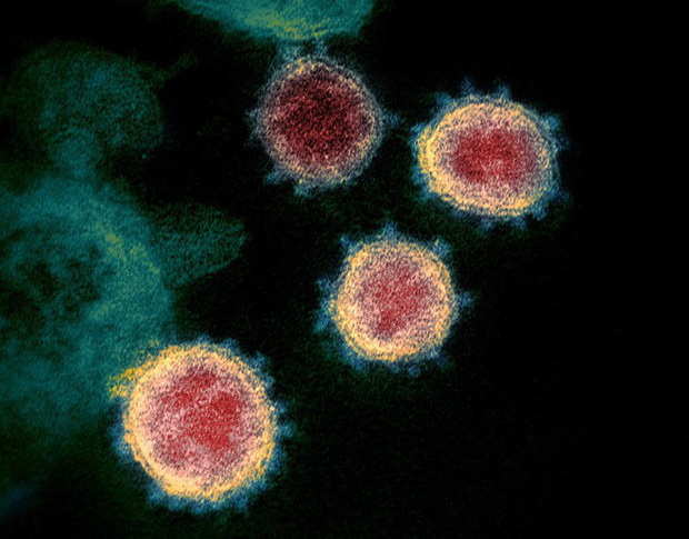  
"Chân dung" virus Corona chủng mới.