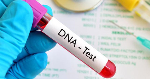  
Nhờ vào kết quả xét nghiệm ADN, gia đình phát hiện bí mật suốt 28 năm trời. (Ảnh: Vector Stock)