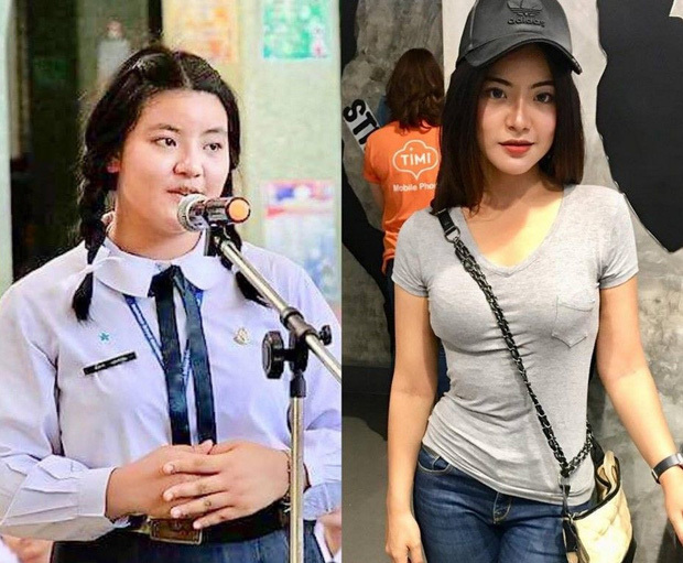  
Hình ảnh trước và sau của cô nàng 22 tuổi.