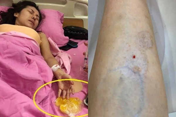  
Những sao nữ Việt bị biến chứng nghiêm trọng do phẫu thuật thẩm mỹ​ (Ảnh: FBNV).