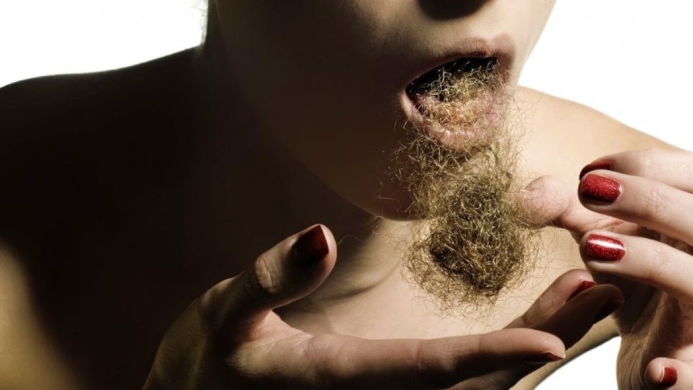  
Hội chứng ăn tóc sẽ ảnh hưởng khá nhiều đến tình trạng sức khỏe. (Ảnh: Instagram)