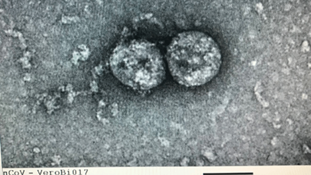  
Hình ảnh virus Corona chủng mới được nuôi cấy, phân lập từ bệnh phẩm của bệnh nhân từ đầu mùa dịch Covid-19. (Ảnh: Thanh Niên)