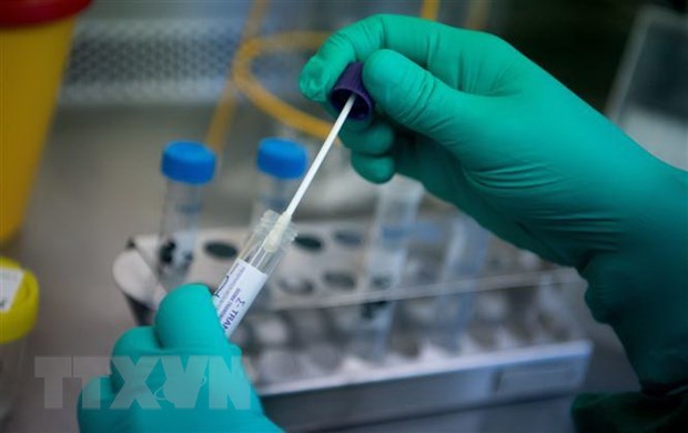  
Các nhà khoa học đang nghiên cứu về virus SARS-CoV-2 (Ảnh: AFP/TTXVN)