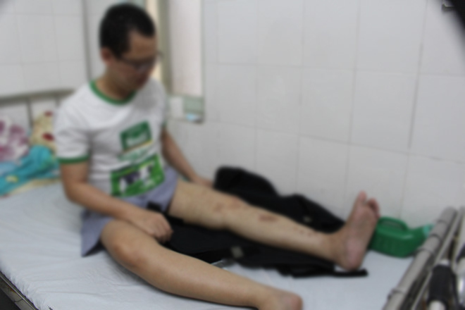 Bệnh nhân trong quá trình chờ phục hồi sau kéo dài chân (Ảnh: Thanh niên)