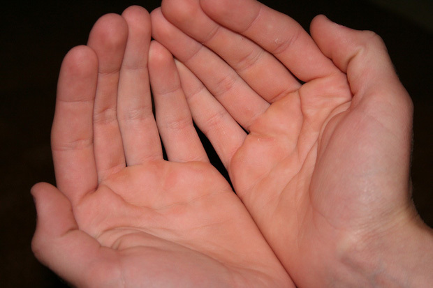 
Người có lòng bàn tay đỏ tươi thường mạnh khỏe, gặp nhiều may mắn. (Ảnh minh họa: Tử Vi)