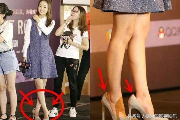  
Mặc dù rất đầu tư trang phục nhưng khi xuất hiện, Triệu Lệ Dĩnh thường xuyên gặp phải vấn đề về đôi chân (Ảnh Weibo)