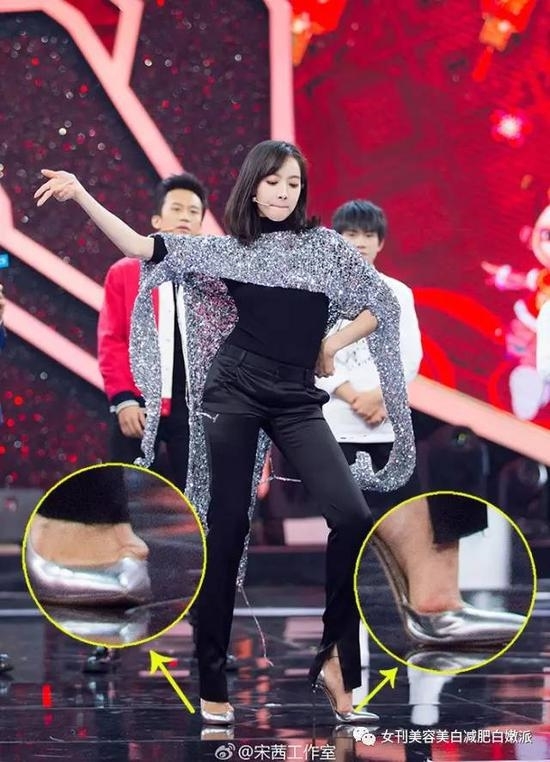  
Tống Thiến - Victoria F(x) là một trong những nạn nhân của giày cao gót mũi nhọn (Ảnh Weibo)