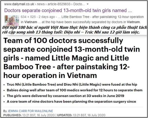  
Tờ DailyMail đã đưa tin về ca phẫu thuật phức tạp của cặp song sinh dính liền ở Việt nam. (Ảnh chụp màn hình)