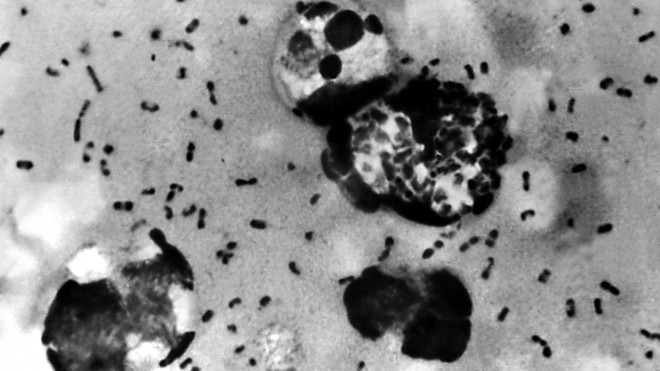  
Loại vi khuẩn Yersinia pestis gây ra bệnh dịch hạch. (Ảnh: Shutterstock)