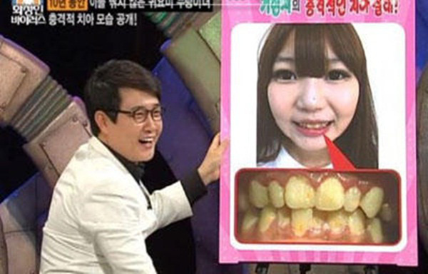  
Hàm răng của Hyun-ji bị hư hỏng vô cùng nặng. (Ảnh: tvN)