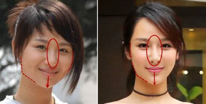  
Phần mũi và xương mặt của Dương Tử có khá nhiều thay đổi (Ảnh Weibo)