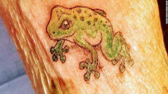  
Hình xăm chú ếch trên cánh tay của cụ bà 103 tuổi. (Ảnh: AP)