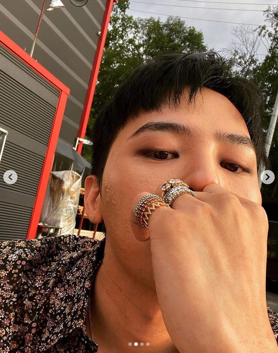 
Ảnh G-Dragon tự chụp, tự đăng để lộ mặt mộc có mụn. Ảnh: Instagram