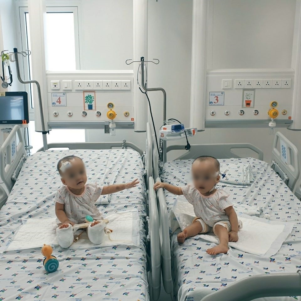  
Hai chị em Trúc Nhi - Diệu Nhi lần đầu được đến gần nhau sau ca phẫu thuật (Ảnh: BVCC)