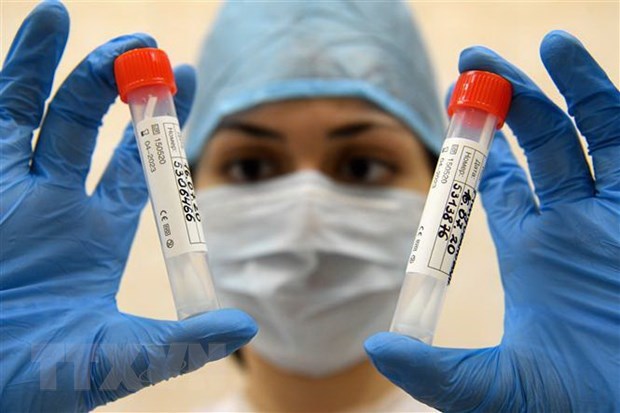  
Nhân viên y tế kiểm tra mẫu xét nghiệm COVID-19 tại Moskva, Nga. (Ảnh minh họa : AFP)
