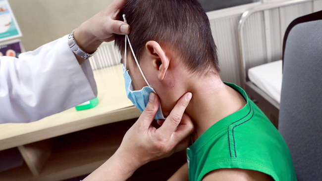 
Một bệnh nhân bị áp- xe tuyến mang tai do vi khuẩn Burkholderia pseudomallei được bác sĩ thăm khám. (Ảnh: Dân Việt).